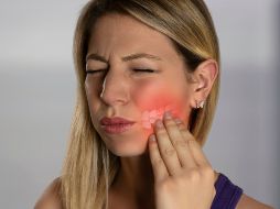 Se aconseja acudir al dentista lo antes posible, especialmente si el dolor persiste, aparece fiebre o la inflamación empeora. CANVA