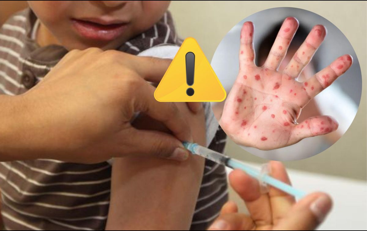 Se trata de un menor de 5 años de edad que hizo escala en el estado de Michoacán, acompañado de su familia. ESPECIAL / IMSS / SUN / ARCHIVO