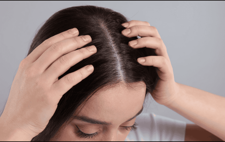 El cuero cabelludo sin cabello está directamente expuesto al sol, por lo que requiere el mismo nivel de protección que el rostro. CANVA