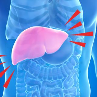 Esta es la verdadera causa de muerte en personas con hígado graso