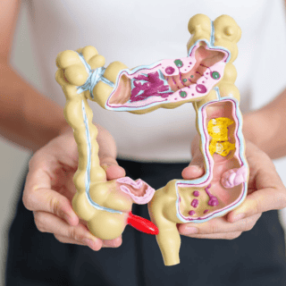 Cómo podrían los antibióticos incrementar el riesgo de cáncer colorrectal