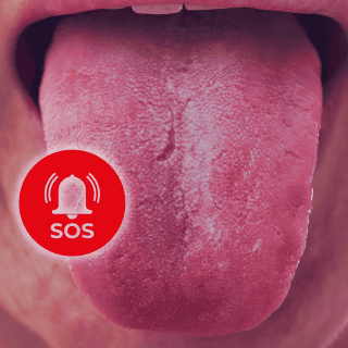 ¿Qué factores favorecen el desarrollo del cáncer en la cavidad oral?