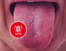 Un paciente con una lesión como úlcera, afta, bulto o cambios en la cavidad oral a un color rojo o blanquecino, que no cede con medicamentos por una semana, debe ser evaluado por un especialista. ESPECIAL / CANVA