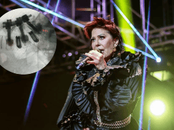 Alejandra Guzmán reaparece tras cirugía de columna. ESPECIAL / IG / @laguzmanmx