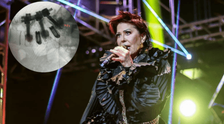 Alejandra Guzmán reaparece tras cirugía de columna. ESPECIAL / IG / @laguzmanmx