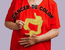 El de colon, es el tercer cáncer más común en la población mexicana y afecta más a hombres que a mujeres. ESPECIAL / CANVA