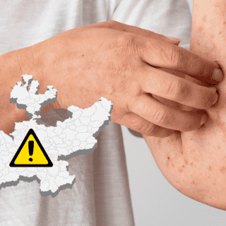 Jalisco se posiciona en segundo lugar a nivel nacional en casos de sarampión