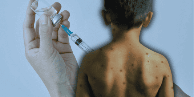 Health in Jalisco: Measles Cases in Zapopan Schools