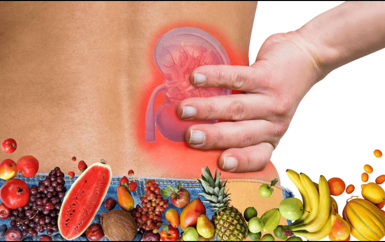 Aunque la carambola puede disfrutarse con moderación por personas sanas, quienes padecen enfermedades renales deben evitarla por completo. CANVA