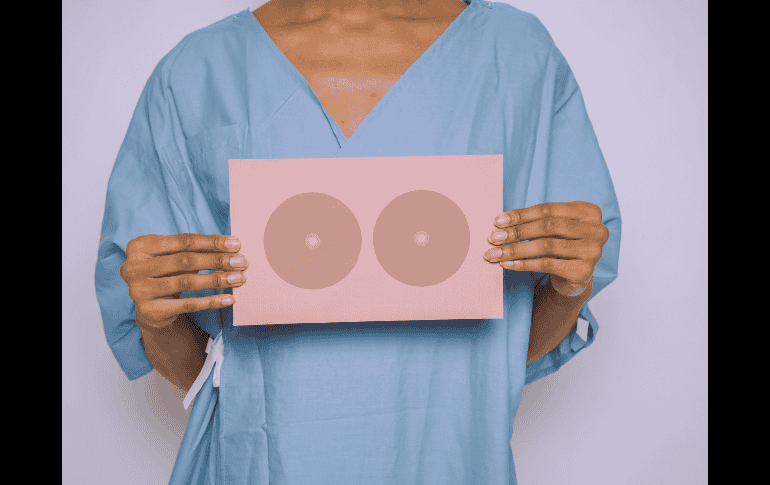 En mujeres con alto riesgo, los protocolos de cáncer de mama cambian. ESPECIAL