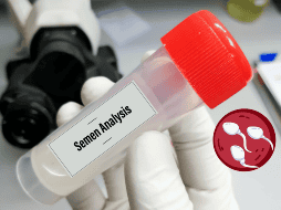 El descubrimiento de que el esperma humano envejece y acumula mutaciones (algunas de las cuales se expanden y dominan con el paso del tiempo) representa un avance significativo en el entendimiento de la genética reproductiva y su impacto en las futuras generaciones. CANVA