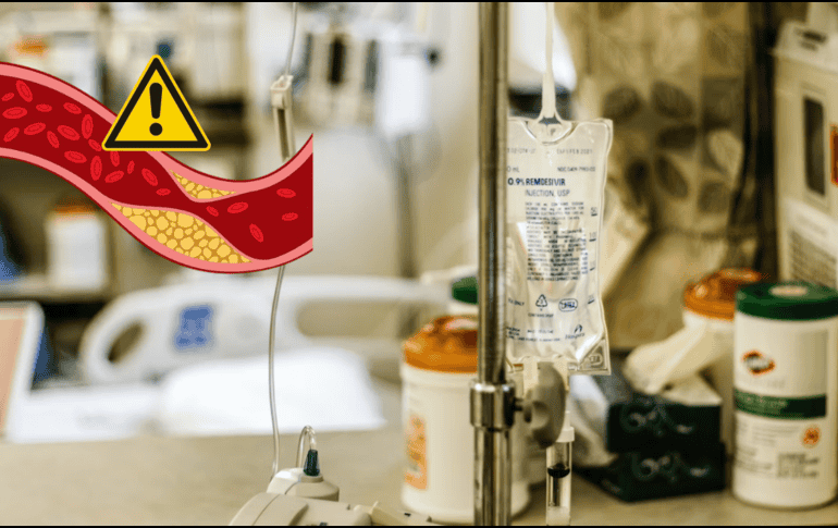 Esto logra la terapia de edición de genes en pacientes con altos niveles de colesterol. UNSPLASH / D. KARASTELEV