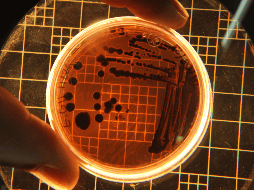 El reino Archaea, que, agrupado dentro del superreino Prokaryota, pasó a ser —con Bacteria y Eukarya— una de las tres ramas del 'árbol de la vida'. ESPECIAL