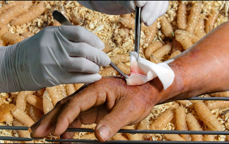 Tras caer en desuso con la llegada de los antibióticos en la década de 1940, la técnica fue retomada con vigor en los años 80 por investigadores como el Dr. Ronald Sherman, en respuesta a la creciente ineficacia de los tratamientos convencionales y la resistencia antimicrobiana. CANVA