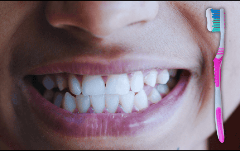 Escoger un cepillo de dientes que no sea adecuado podría tener un gran impacto en tu salud bucal. ESPECIAL / CANVA