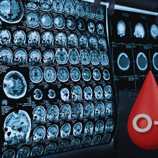 Este elemento en la sangre podría ser clave en fases tempranas del alzhéimer