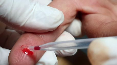 Algunos síntomas del VIH son similares a los de la influenza y pueden aparecer entre dos y cuatro semanas después de la infección. EL INFORMADOR / ARCHIVO