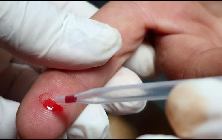 Algunos síntomas del VIH son similares a los de la influenza y pueden aparecer entre dos y cuatro semanas después de la infección. EL INFORMADOR / ARCHIVO