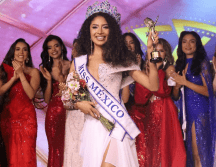 Su causa resulta ideal para el concurso, ya que el certamen de Miss Mundo está más enfocado en la 