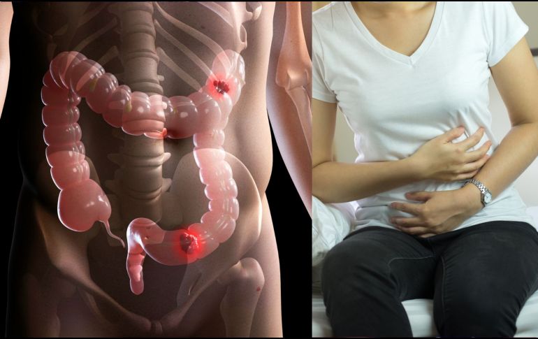 Cuando el cáncer avanza, o incluso en fases tempranas, existen otros indicadores que requieren una evaluación médica inmediata. CANVA