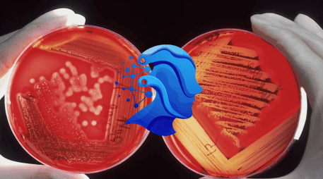 Esta herramienta reduce el sesgo en análisis patológicos de cáncer. UNSPLASH / NCI