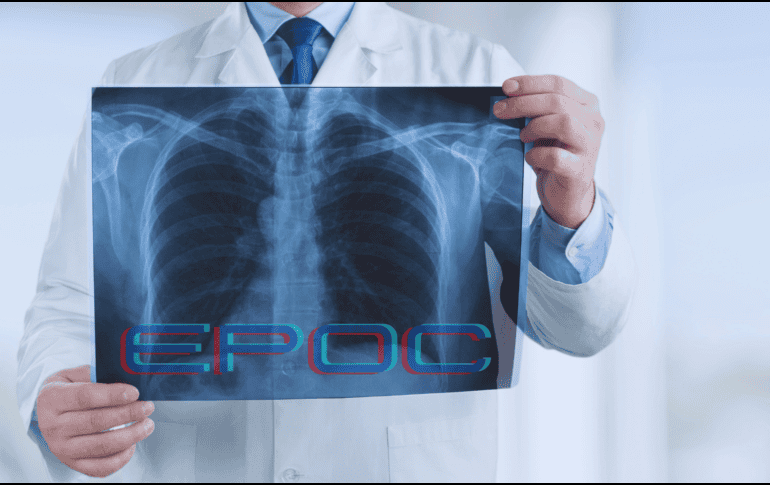 La EPOC se manifiesta principalmente en personas mayores de 40 años y hoy figura entre las principales causas de fallecimiento en México. ESPECIAL / CANVA