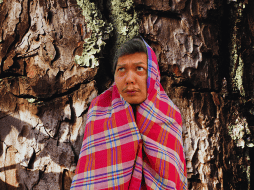 Las personas que padecen este mal presentan un desarrollo de crecimientos cutáneos anormales, similares a la corteza de un árbol, de diversas texturas y tamaños. ESPECIAL / CANVA