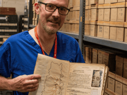 Los casos en personas jóvenes han aumentado en los últimos años y se prevé que se dupliquen entre 2010 y 2030. EFE/ London North West University Healthcare NHS Trust