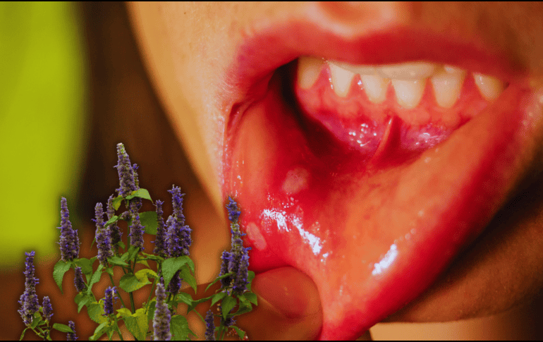 El poder curativo de la agastache radica en su capacidad para actuar de manera directa sobre las áreas afectadas. ESPECIAL / CANVA