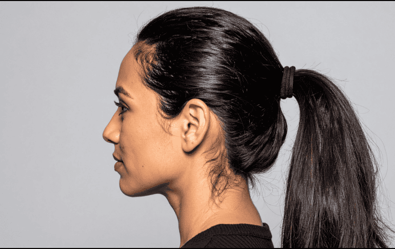 Uno de los efectos más comunes de amarrarse el cabello a diario es el debilitamiento de la fibra capilar. CANVA