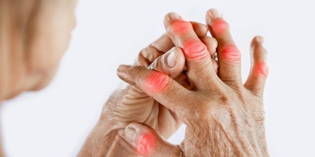 Fr&iacute;o: Osteoartritis afecta a seis de cada 10 mexicanos y empeora con este clima