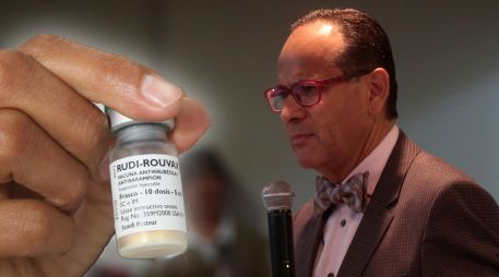 EnJalisco se acumulan alrededor de mil 020 casos de sarampión. EL INFORMADOR / ARCHIVO