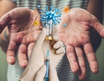 La vacunación contra el sarampión es la principal medida de prevención. ESPECIAL / CANVA