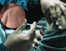 Actualmente, 26 personas se encuentran hospitalizadas a causa del sarampión. EL INFORMADOR/A. Navarro ESPECIAL/Gobierno de México