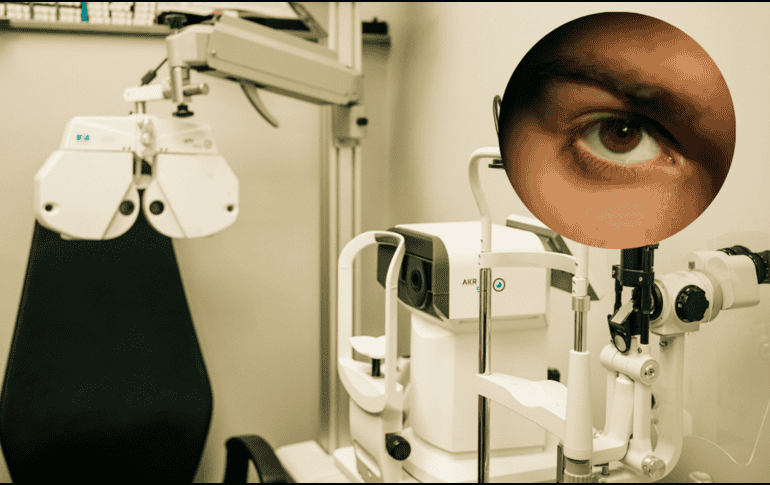 Se debe ir a revisión oftalmológica cada cierto tiempo. UNSPLASH / EYES ON ST ALBANS / K. DÖRNER