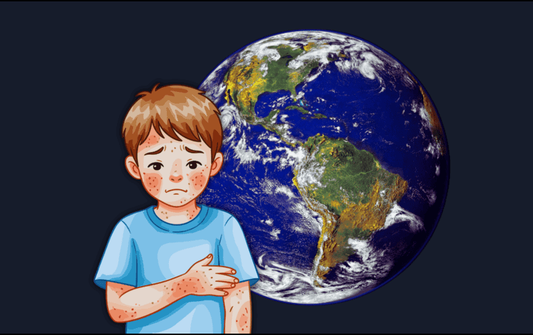 La disminución sostenida de las coberturas es el principal detonante del regreso del sarampión: ESPECIAL / CANVA