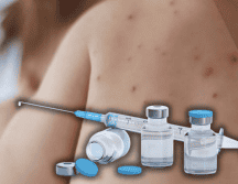 Las autoridades buscan aplicar 1.3 millones de vacunas en un periodo de 45 días para contener el brote de sarampión. ESPECIAL/Gobierno de México/Canva