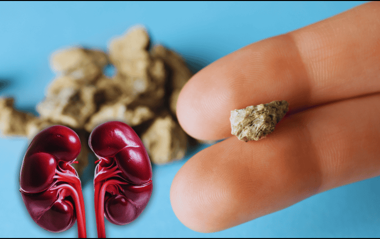 Desde luego, expulsar esas 