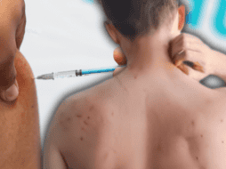 El aumento de casos de sarampión en Jalisco ocurre mientras en el estado se desarrolla la Serie del Caribe, y a cuatro meses de ser una de las sedes de la Copa del Mundo 2026. EL INFORMADOR/ARCHIVO ESPECIAL/Canva