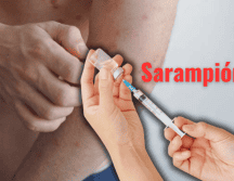 Especialistas de la Universidad Autónoma Metropolitana (UAM) externaron su preocupación ante el brote de sarampión en México. ESPECIAL/Canva