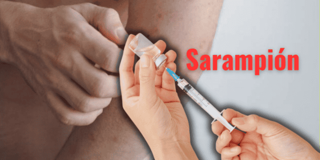 &iquest;Cu&aacute;l es la causa del brote de sarampi&oacute;n en M&eacute;xico, el pa&iacute;s con m&aacute;s contagios en Am&eacute;rica en 2026?