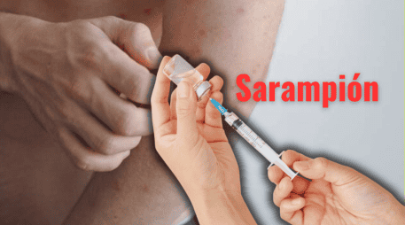 Especialistas de la Universidad Autónoma Metropolitana (UAM) externaron su preocupación ante el brote de sarampión en México. ESPECIAL/Canva