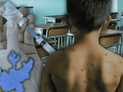 Hasta el jueves de la semana pasada, eran 30 las escuelas afectadas por sarampión en Jalisco. ESPECIAL