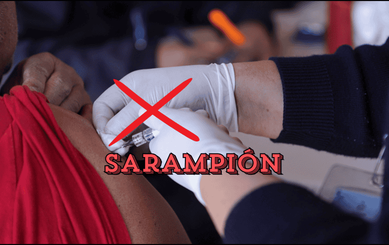 Es importante estar atento ante cualquier sospecha de sarampión y acudir al centro de salud más cercano. EL INFORMADOR / ARCHIVO