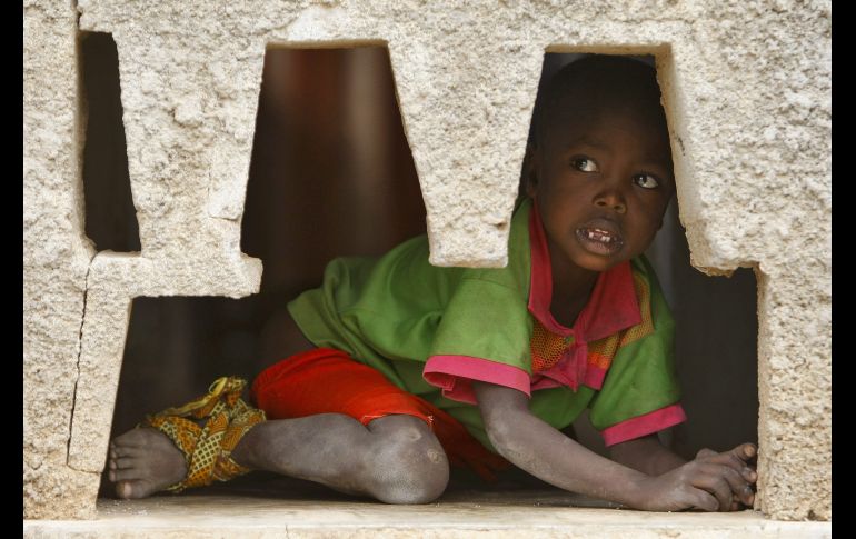 Los niños no sólo están hambrientos. Casi la mitad de los de Al Tina han enfermado en las últimas dos semanas, sufriendo fiebre, diarrea o infecciones respiratorias. EFE/ARCHIVO