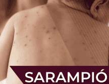 Las autoridades invitan a la población a acudir al  Centro de Salud o módulo de vacunación más cercano para recibir la vacuna contra el sarampión. Gobierno de México