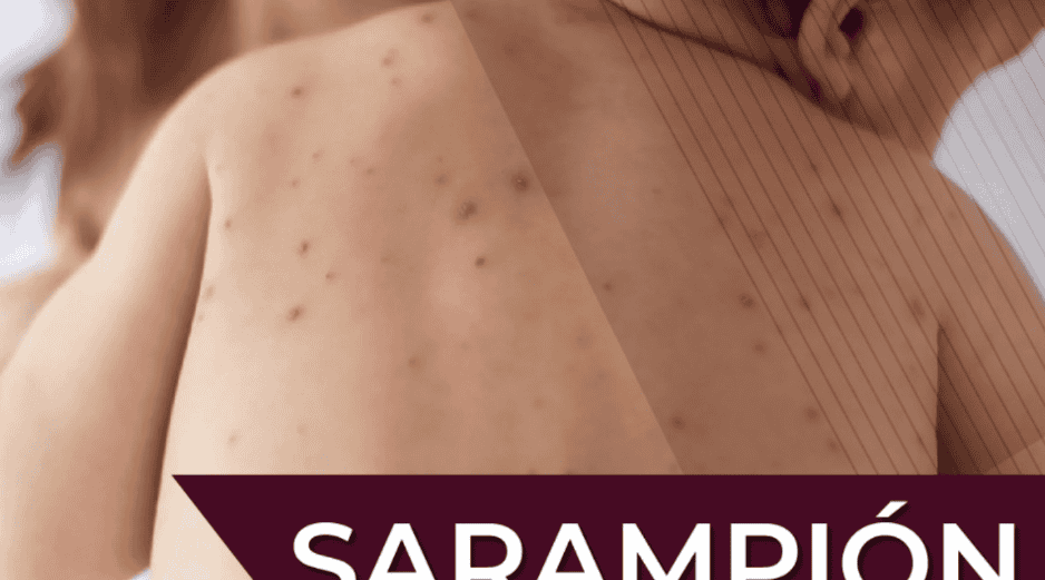 Las autoridades invitan a la población a acudir al  Centro de Salud o módulo de vacunación más cercano para recibir la vacuna contra el sarampión. Gobierno de México