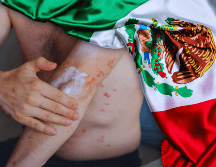 De acuerdo con cifras oficiales, entre 2025 y 2026 se han registrado 9 mil 74 casos acumulados de sarampión en México. ESPECIAL / CANVA