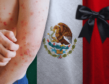 El número oficial de decesos confirmados por sarampión es de 28, con un caso adicional en proceso de dictaminación, que podría elevar la cifra a 29. ESPECIAL / CANVA