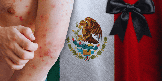 Sarampi&oacute;n en M&eacute;xico: &iquest;Cu&aacute;ntos muertos van en M&eacute;xico por brote hasta este d&iacute;a?